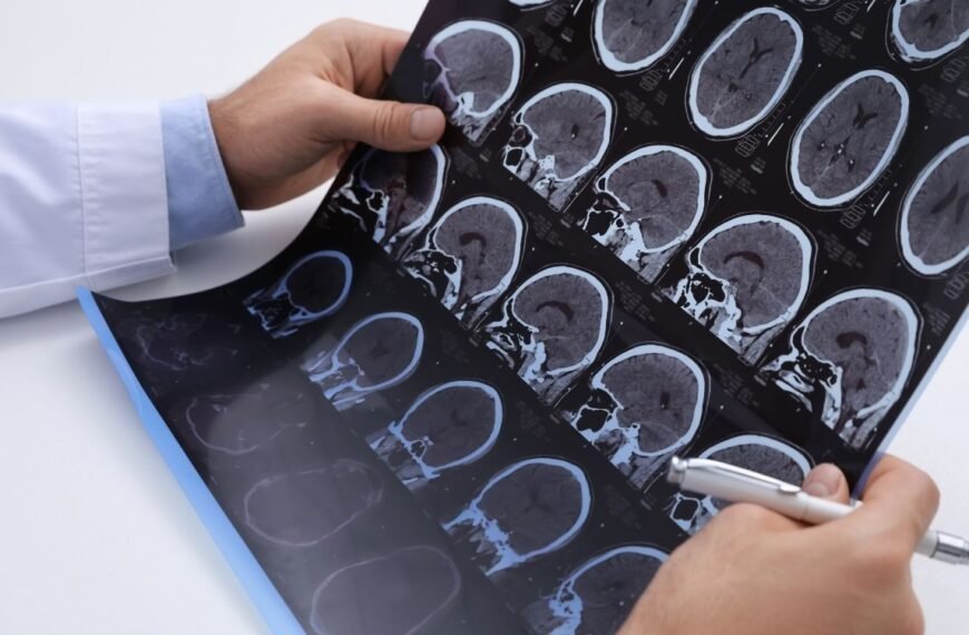 Médico analisando exames de imagem do cérebro, com várias tomografias em lâmina, representando a investigação de menopausa e esclerose múltipla.