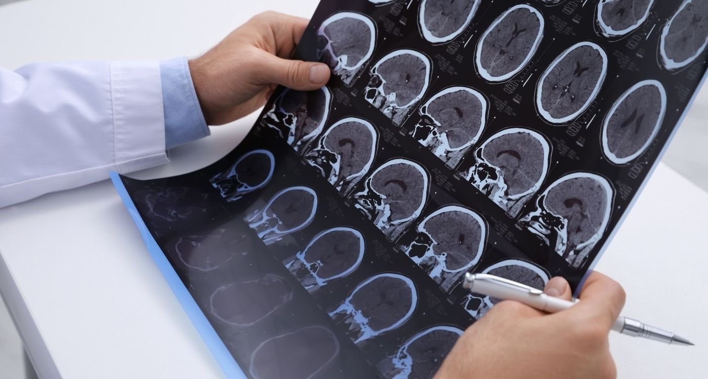 Médico analisando exames de imagem do cérebro, com várias tomografias em lâmina, representando a investigação de menopausa e esclerose múltipla.